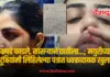 सासऱ्याने
