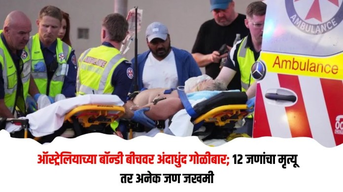 बॉन्डी