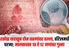 किरकोळ वादातून दोन तरूणांवर हल्ला, हॉटेलमधील घटना; मालकासह 10 ते 12 जणांवर गुन्हा